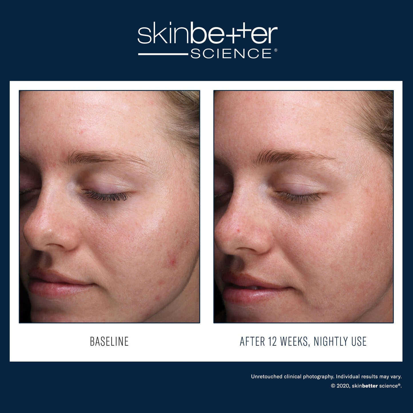 SkinBetter Science AlphaRet Clearing Serum — image 3