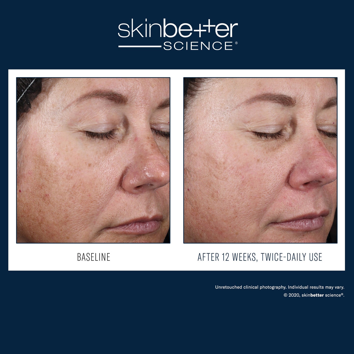 SkinBetter Science Alto Advanced Defense and Repair Serum — image 3