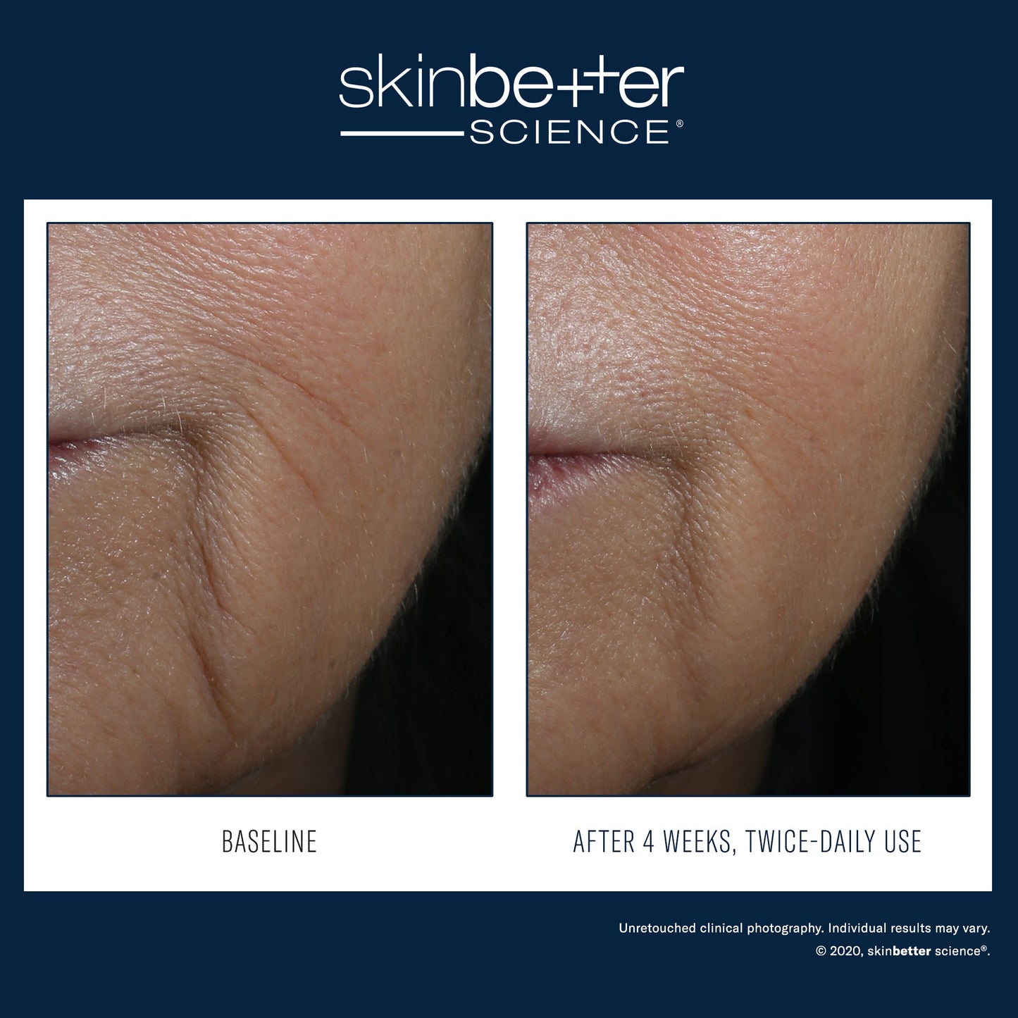 SkinBetter Science Interfuse Intensive Treatment LINES — image 3