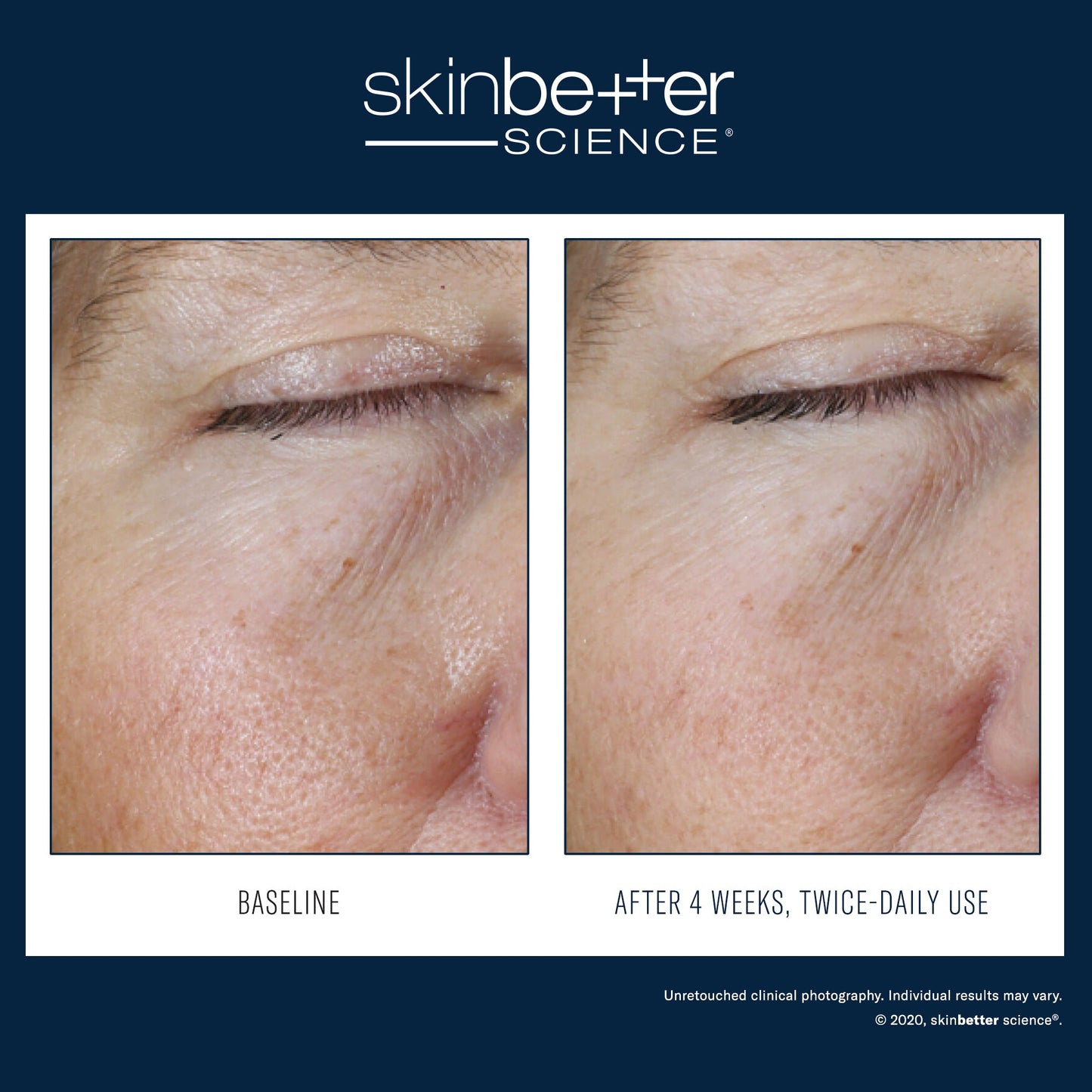SkinBetter Science Instant Effect Gel EYE — image 3