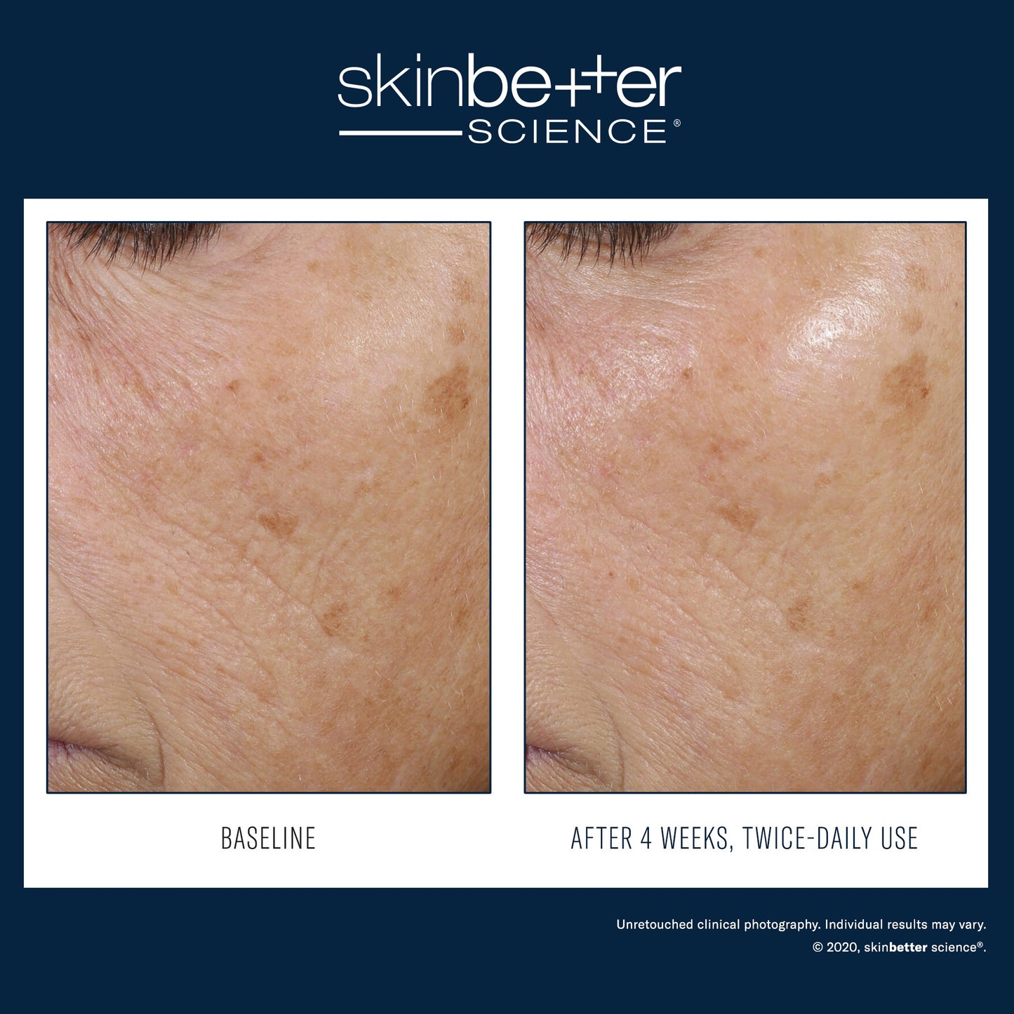 SkinBetter Science Trio Rebalancing Moisture Treatment — image 3