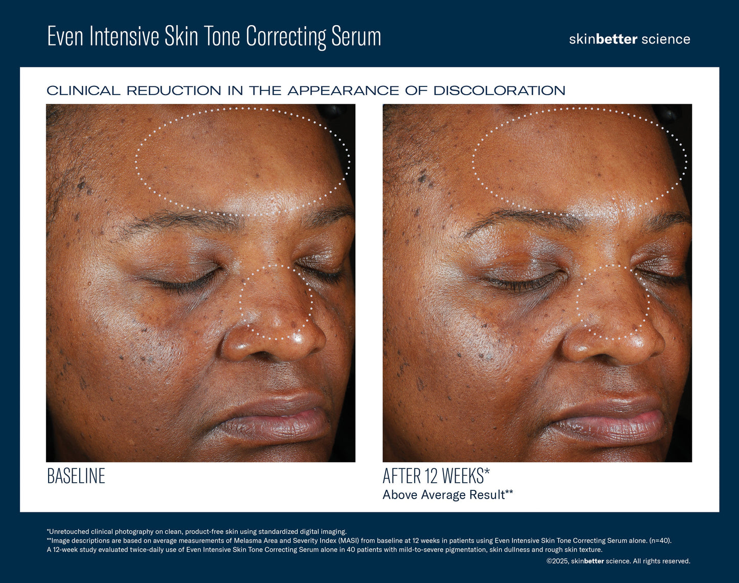 SkinBetter Science Even Intensive Skin Tone Correcting Serum — image 4