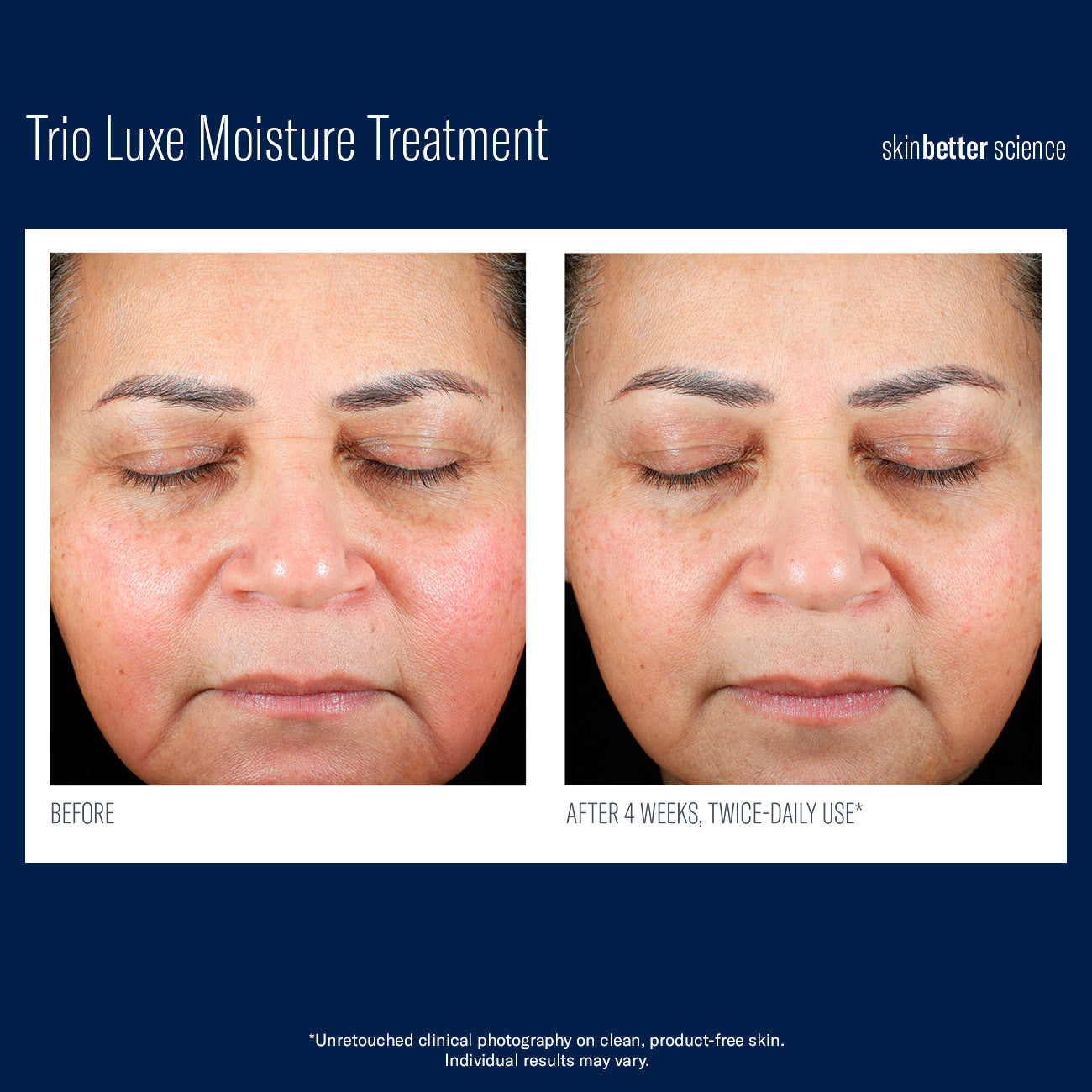 SkinBetter Science Trio Luxe Moisture Treatment — image 3