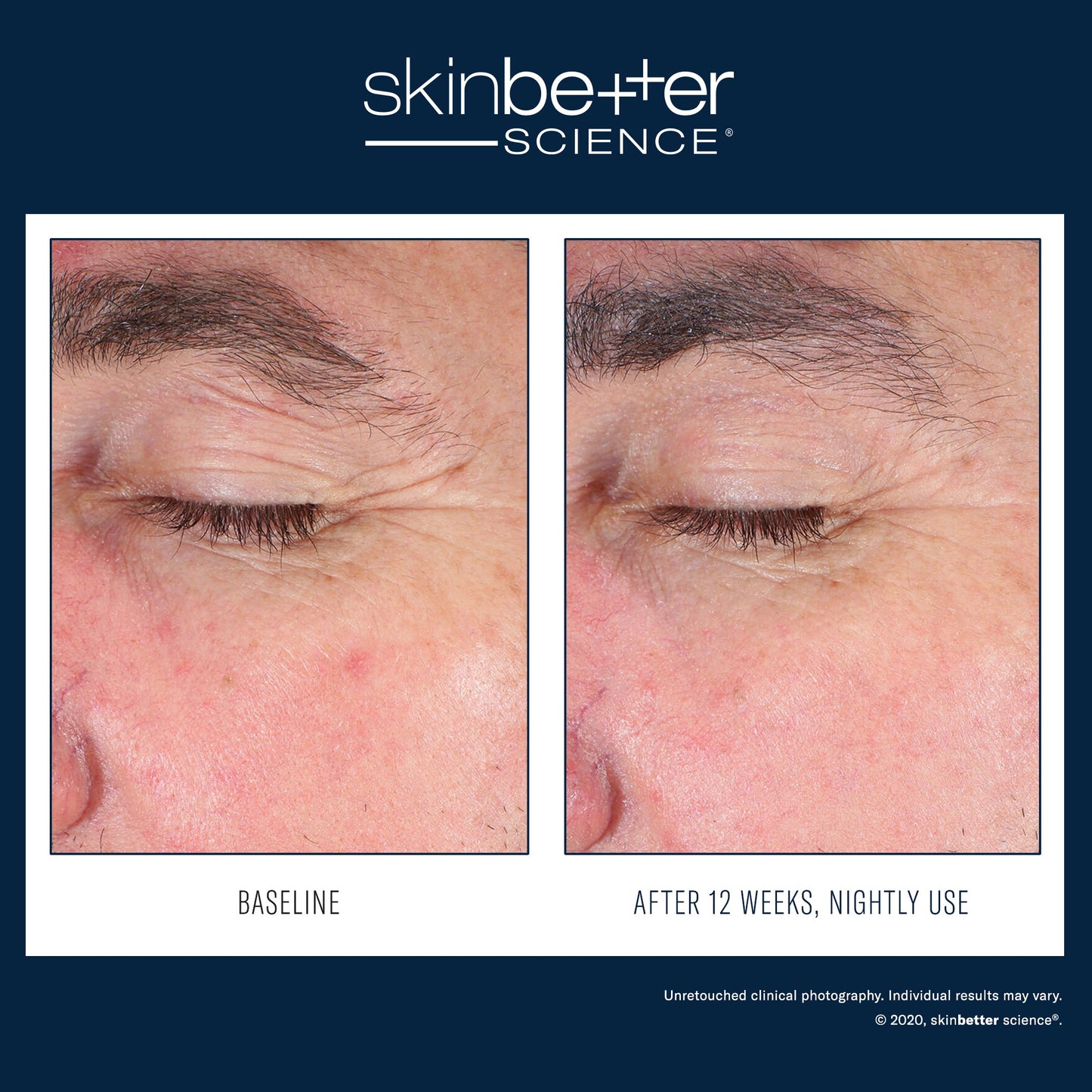 SkinBetter Science EyeMax AlphaRet Overnight Cream — image 3