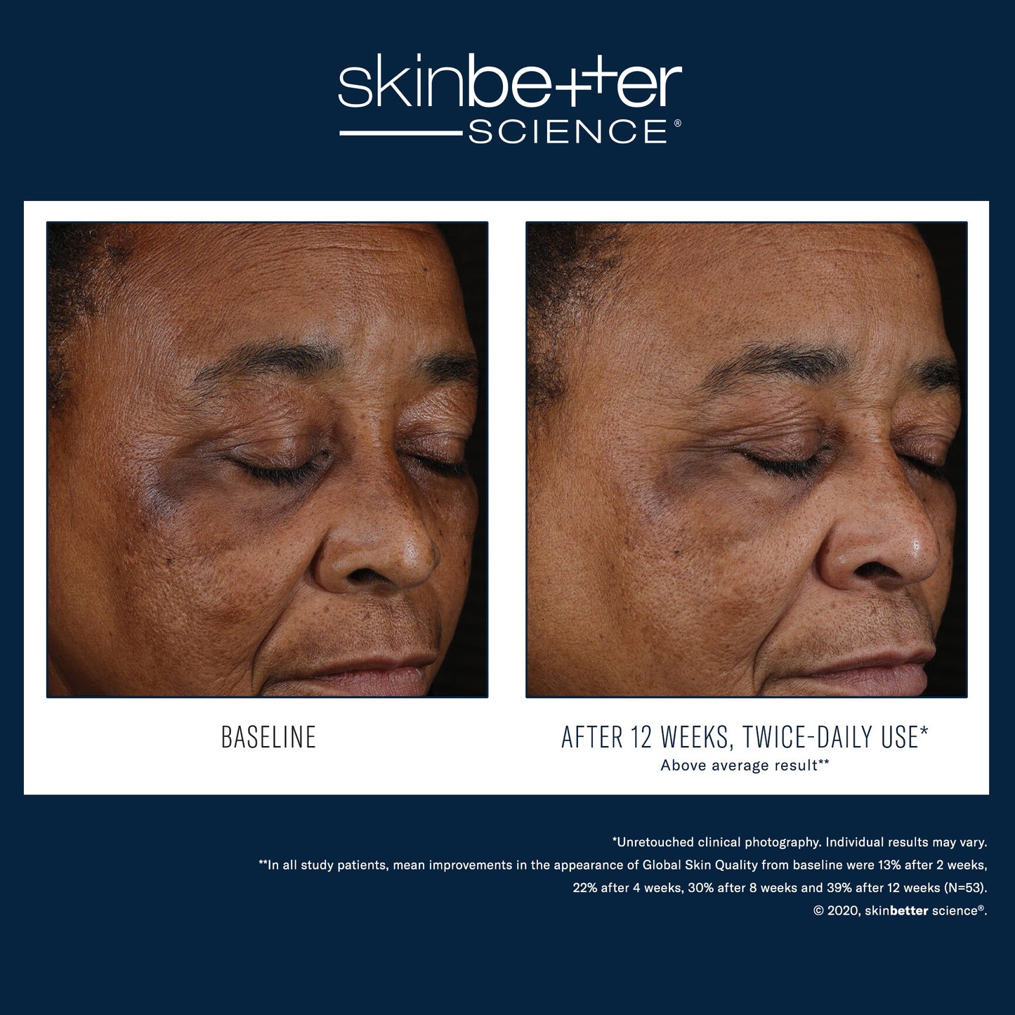 SkinBetter Science Mystro Active Balance Serum — image 3