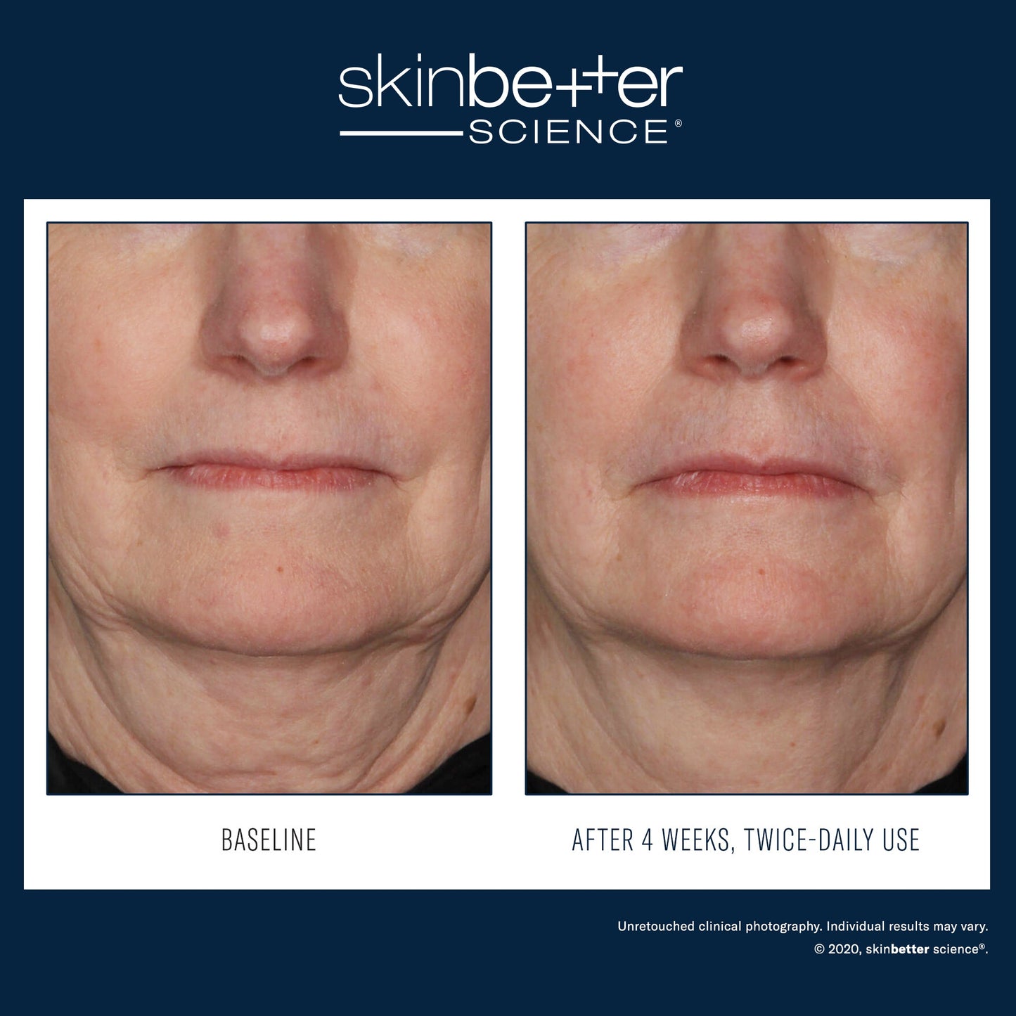 SkinBetter Science InterFuse Treatment Cream FACE & NECK — image 3