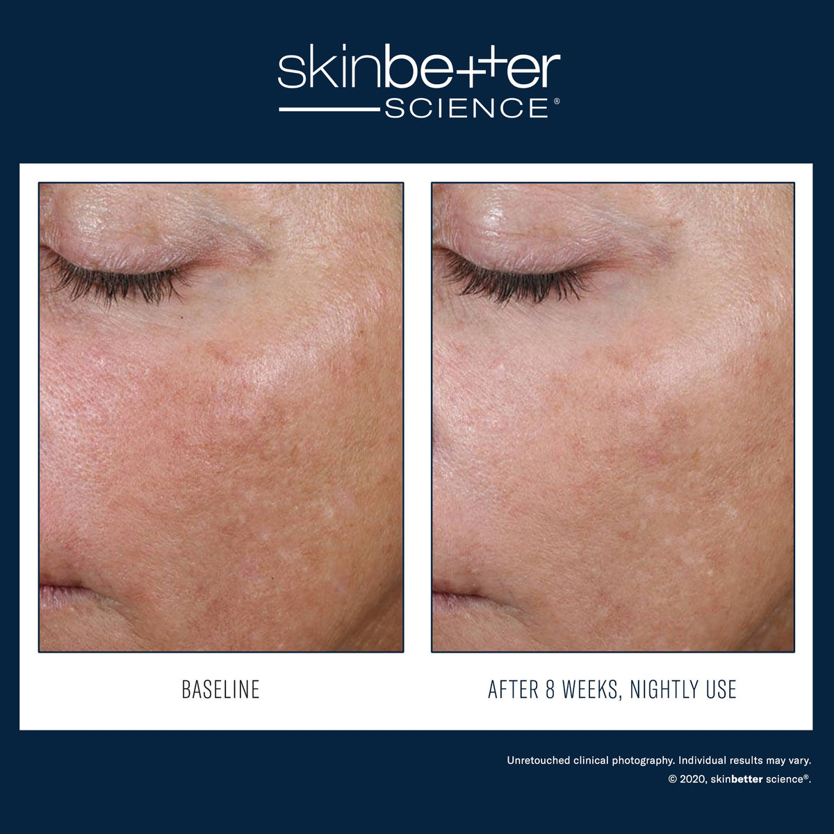 SkinBetter Science AlphaRet Overnight Cream — image 3