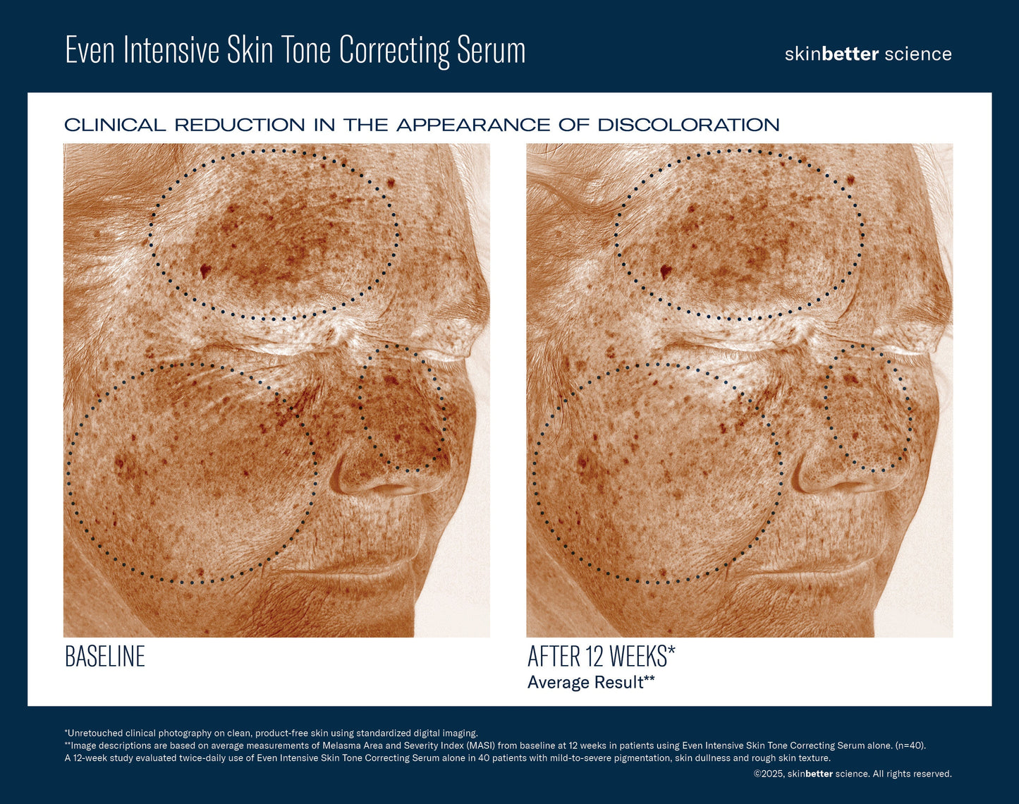 SkinBetter Science Even Intensive Skin Tone Correcting Serum — image 3