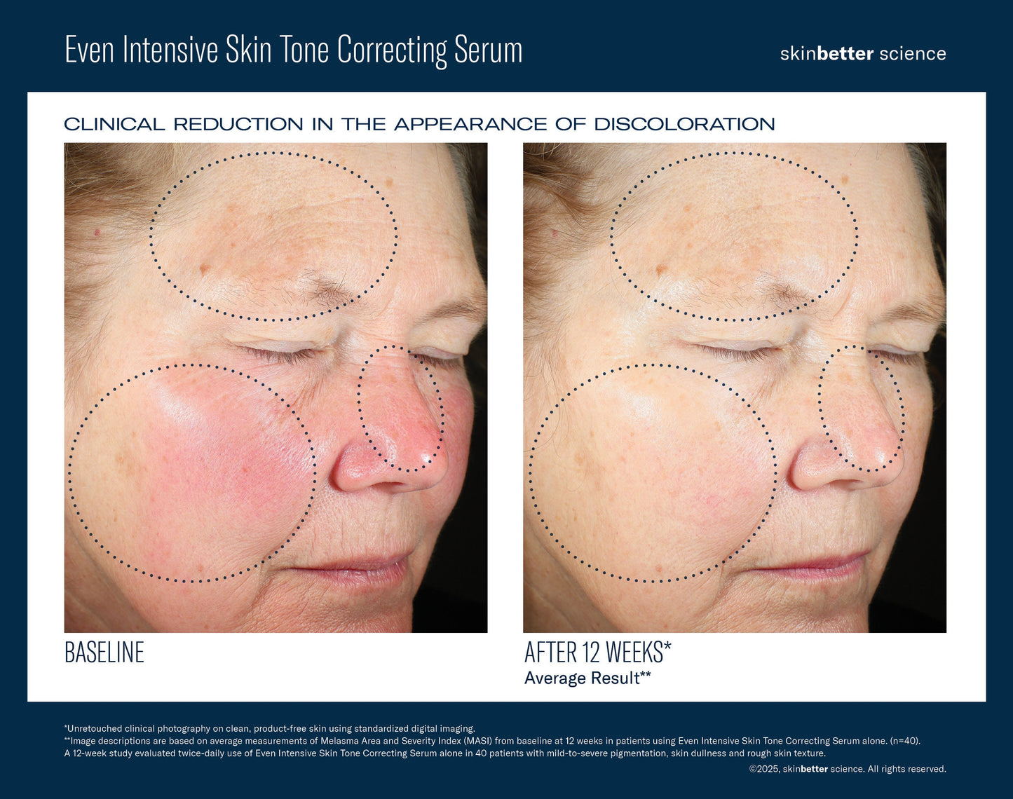 SkinBetter Science Even Intensive Skin Tone Correcting Serum — image 2